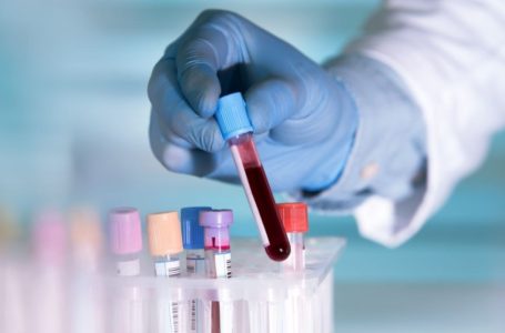 Betul Ke Darah ‘O’ Kebal COVID-19? Habistu Darah-Darah Lain?