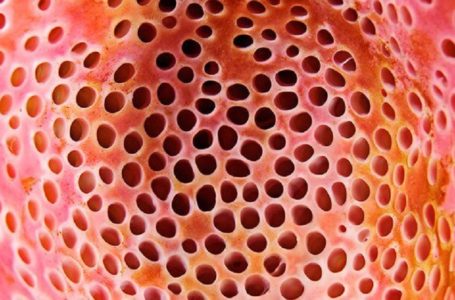 Geli & Seram Tengok Lubang-lubang Kecil? Ini 5 Perkara Tentang Trypophobia